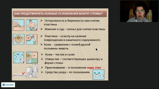 Вебинар 19 мая 2020 г. на тему «Можно ли самостоятельно лечить осложнения стомы?» смотреть онлайн