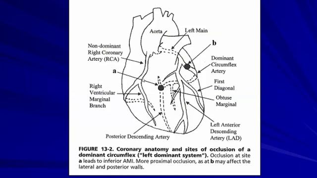 7-03-22 Енисеева ЕС Острый коронарный синдром.mp4