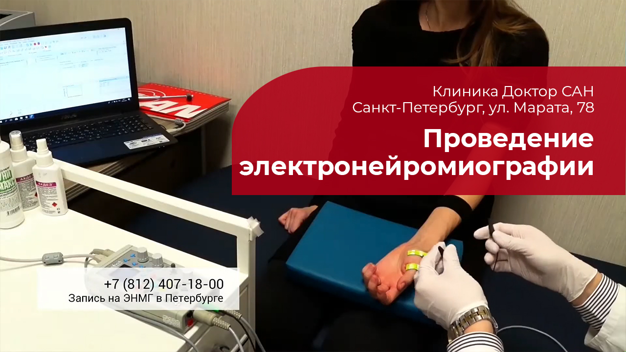 ЭНМГ конечностей: ✅ проведение электронейромиографии смотреть онлайн