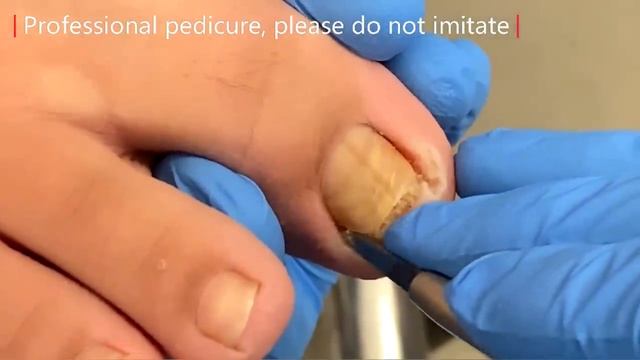Pedicure Tutorial: Well Repaired Toenails, Efficient And Painless【Xue Yidao】
