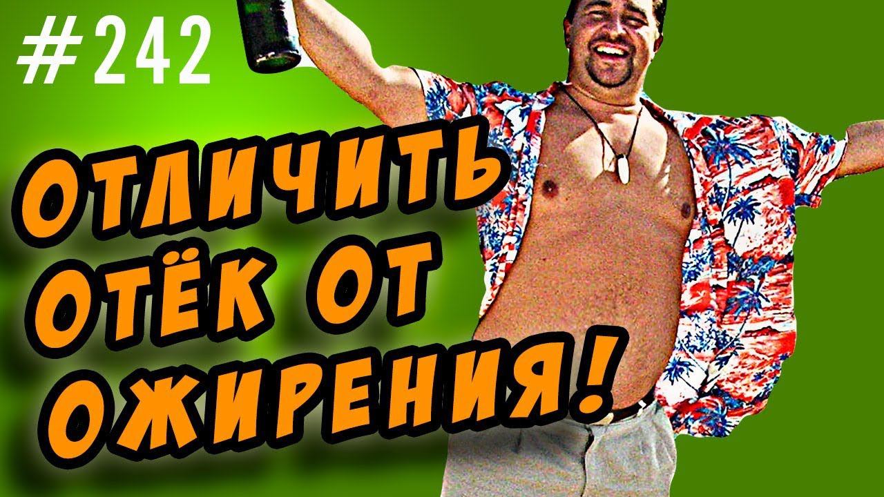 ожирение или отечность. как отличить жир от отека смотреть онлайн