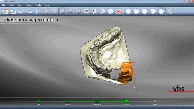 Full Anatomy Crown Digital Design VHS CAD смотреть онлайн