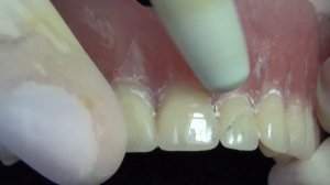 Идеальная полировка протезов  Jota Kit Denture Base 8 инструментов