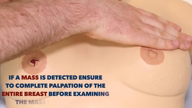 Breast Examination - OSCE Guide