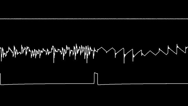C64 Rob Hubbard's "Knucklebuster" oscilloscope view (improved version) смотреть онлайн