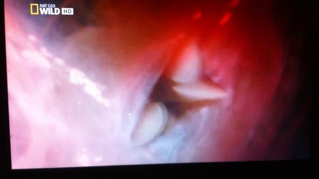 Пиявки.Лечение пиявками.Взгляд изнутри.