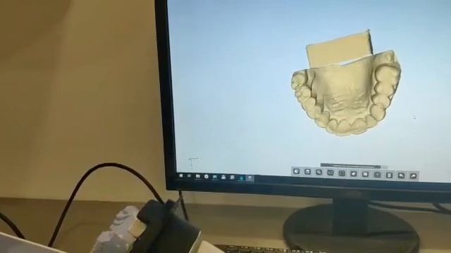 New dental 3D scanner Shining DS-EX Pro Upgrade смотреть онлайн