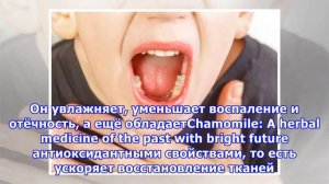 Что делать, если болит горло: советы, которые точно помогут
