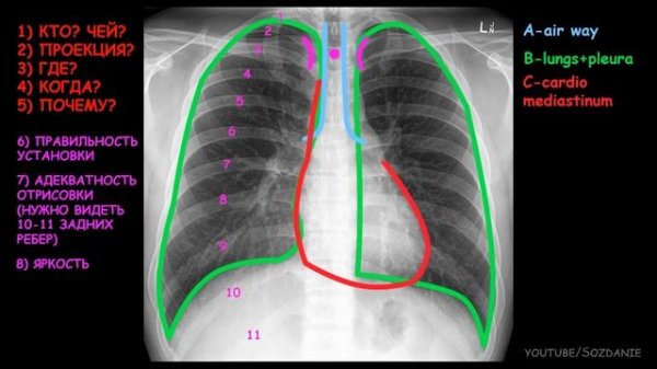 2.1.Рентгеноанатомия грудной клетки.mp4