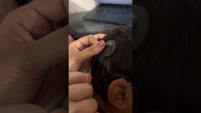 Cochlear processor (MEDEL) usage instructions Part-2 смотреть онлайн