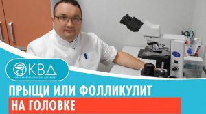 ? Прыщи или фолликулит на голове. Клинический случай №581