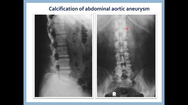 UPPER GIT RADIOLOGY for Undergraduate Medical students смотреть онлайн