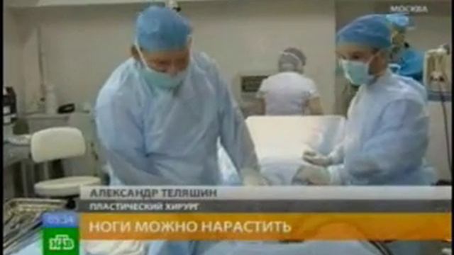 Удлинение ног в Beauty Plaza смотреть онлайн