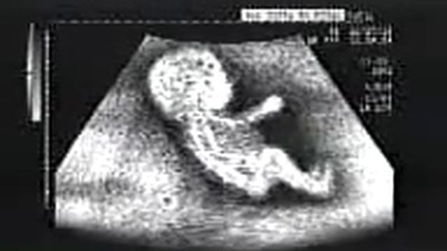 Новейшее узи, малыш рулит смотреть онлайн