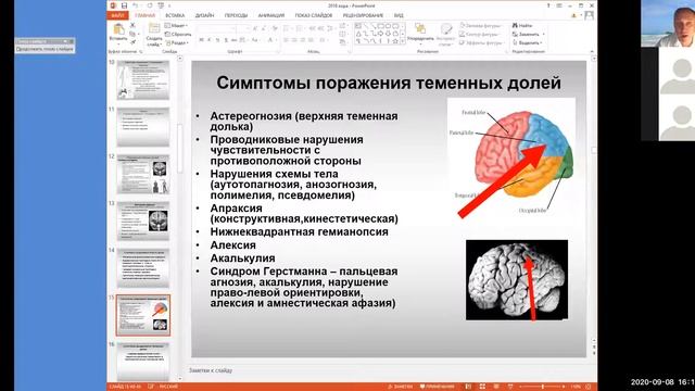 6. Кора головного мозга / cortex смотреть онлайн