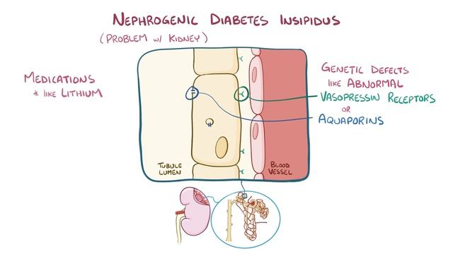 Diabetes insipidus - causes, symptoms, diagnosis, treatment, pathology.mp4 смотреть онлайн
