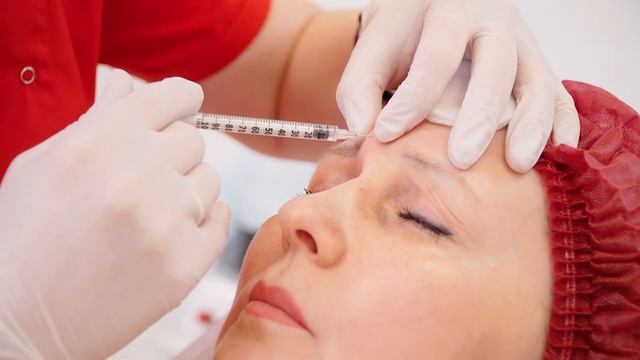 ? Ботулинотерапия | Центр контурного макияжа 