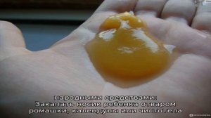 Советы доктора Комаровского: желтые сопли у ребенка