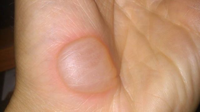 Смертельно опасные пауки и насекомые России смотреть онлайн