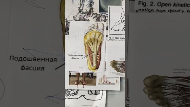 ОБУВЬ ПРИ ПЛОСКОСТОПИИ.???Почему стелька не работает если обувь не правильная? смотреть онлайн