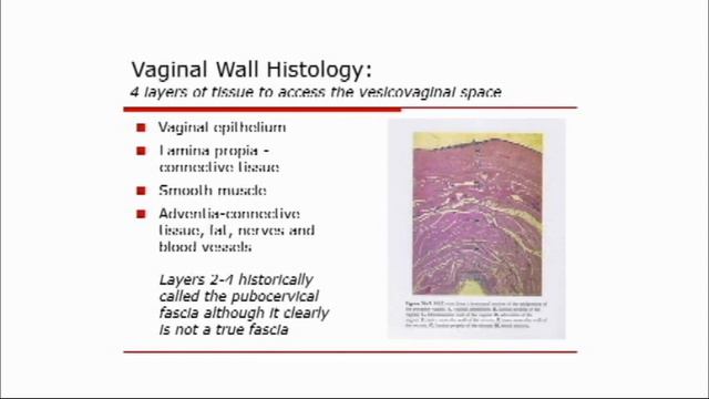 Elevate 5 смотреть онлайн