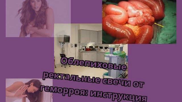 Облепиховые ректальные свечи от геморроя: инструкция смотреть онлайн