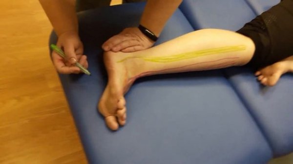 Осмотр и тестирование стопы  Мышцы и упражнения для развития стопы  Полное видео