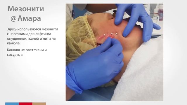 Мезонити, оригинальный проморолик Амара Красота смотреть онлайн