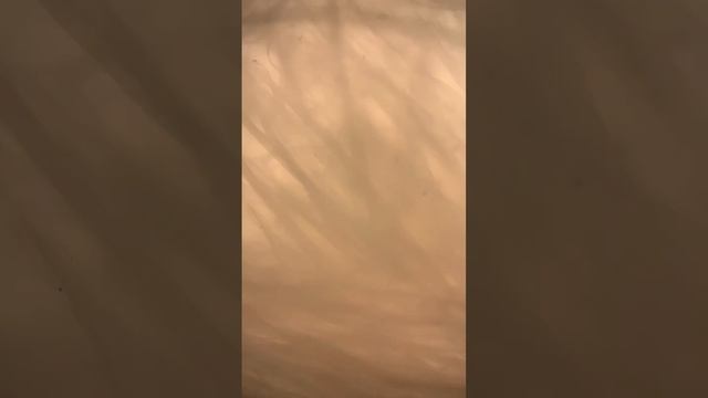 Вот почему нужно стирать игрушки (увеличение 400Х) смотреть онлайн