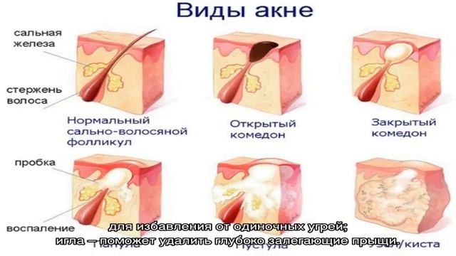 Ложка Уно для чистки лица смотреть онлайн