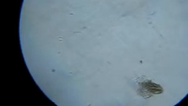 микробы в водопроводной воде 2 смотреть онлайн