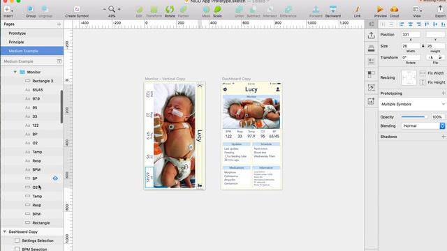 Detach Symbols in Sketch смотреть онлайн