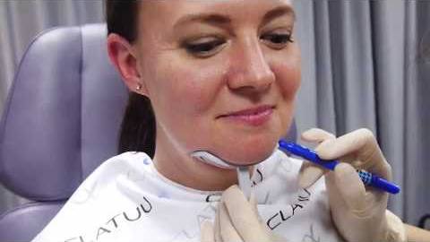 Коррекция фигуры холодом (криолиполиз) на аппарате Clatuu Classys смотреть онлайн