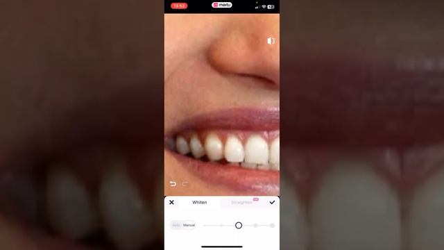 КАК ОТБЕЛИТЬ ЖЕЛТЫЕ ЗУБЫ НА ФОТО. Придожение Meitu смотреть онлайн
