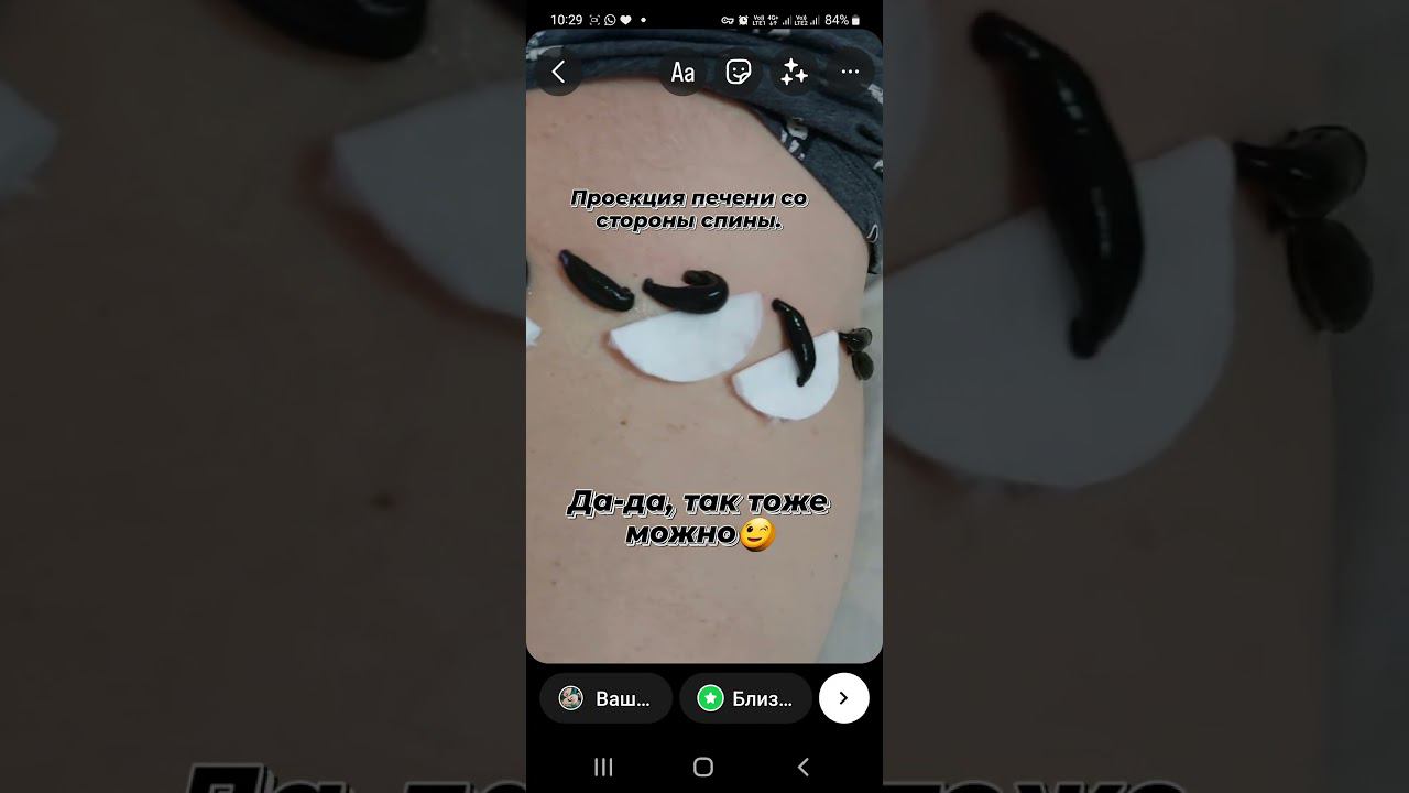 ГИРУДОТЕРАПИЯ. Обучение. смотреть онлайн