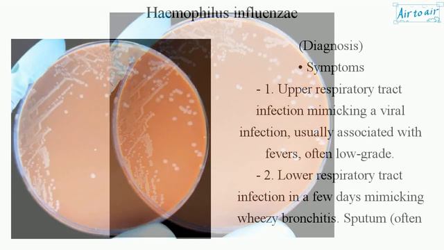 Haemophilus Influenzae