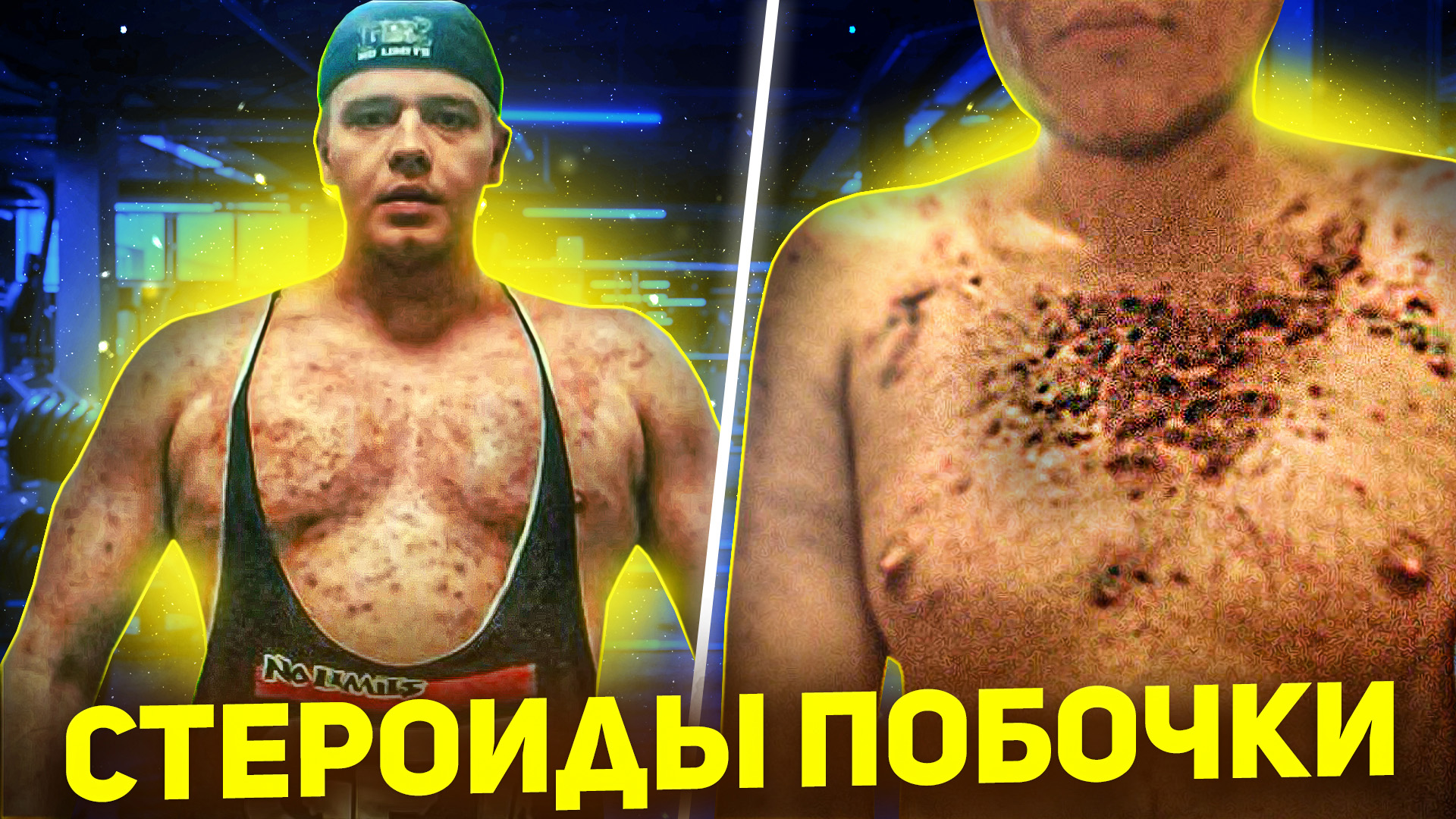 ВЛАД ХОТЕЛ СТАТЬ КАЧКОМ, НО СГНИЛ ЗАЖИВО смотреть онлайн