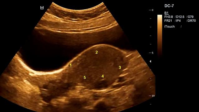 201408281443040019SMP смотреть онлайн