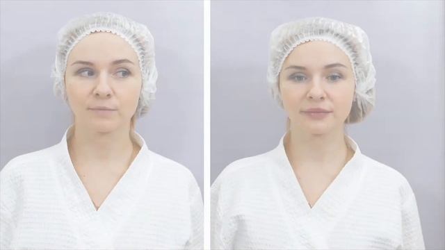 Контурная пластика губ. смотреть онлайн