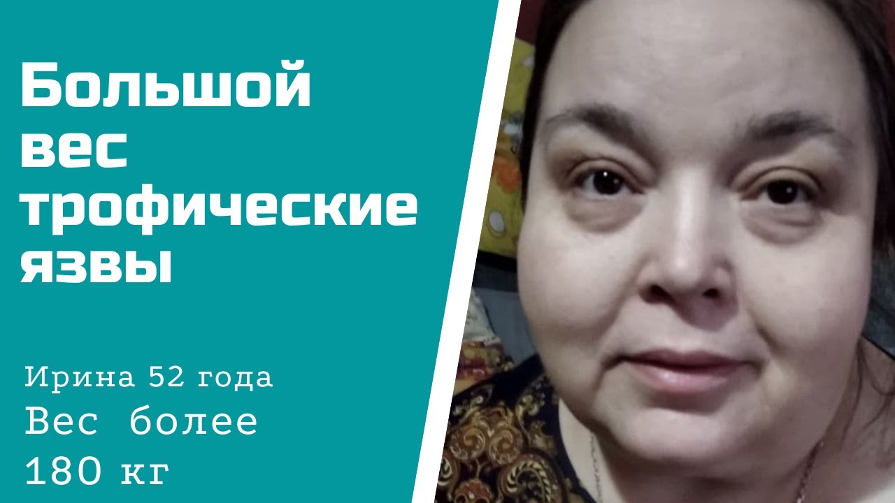 Женщина с весом более 180 кг.mp4 смотреть онлайн
