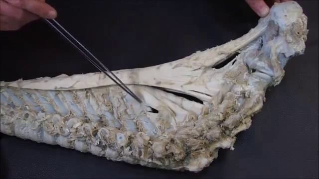 соединение позвонков и ребер с позвонками смотреть онлайн