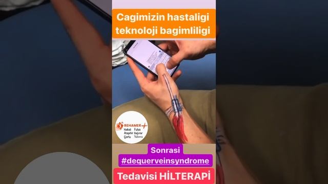 #hilterapi смотреть онлайн