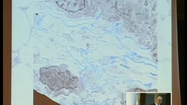 Sawa Kostin, Mycardial Regeneration and cardiac tissue engineering смотреть онлайн