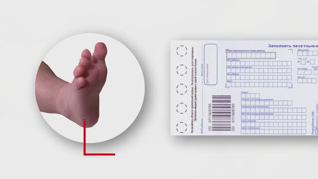 Что такое «Скрининг новорожденных» или «Пяточный тест» смотреть онлайн
