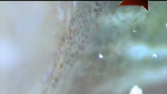 Борьба с улитками на дачном участке