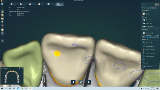 UPCAD Basic Design「UP3D Tech Lesson」 смотреть онлайн