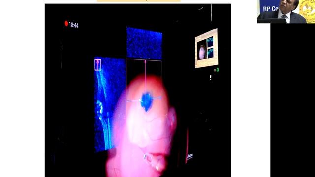 Live Webinar - Recent Advances in Management of Diabetic Retinopathy смотреть онлайн