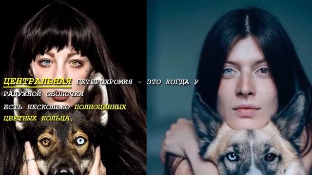 ГЕТЕРОХРОМИЯ У ЛЮДЕЙ. РАЗНЫЙ ЦВЕТ ГЛАЗ. смотреть онлайн