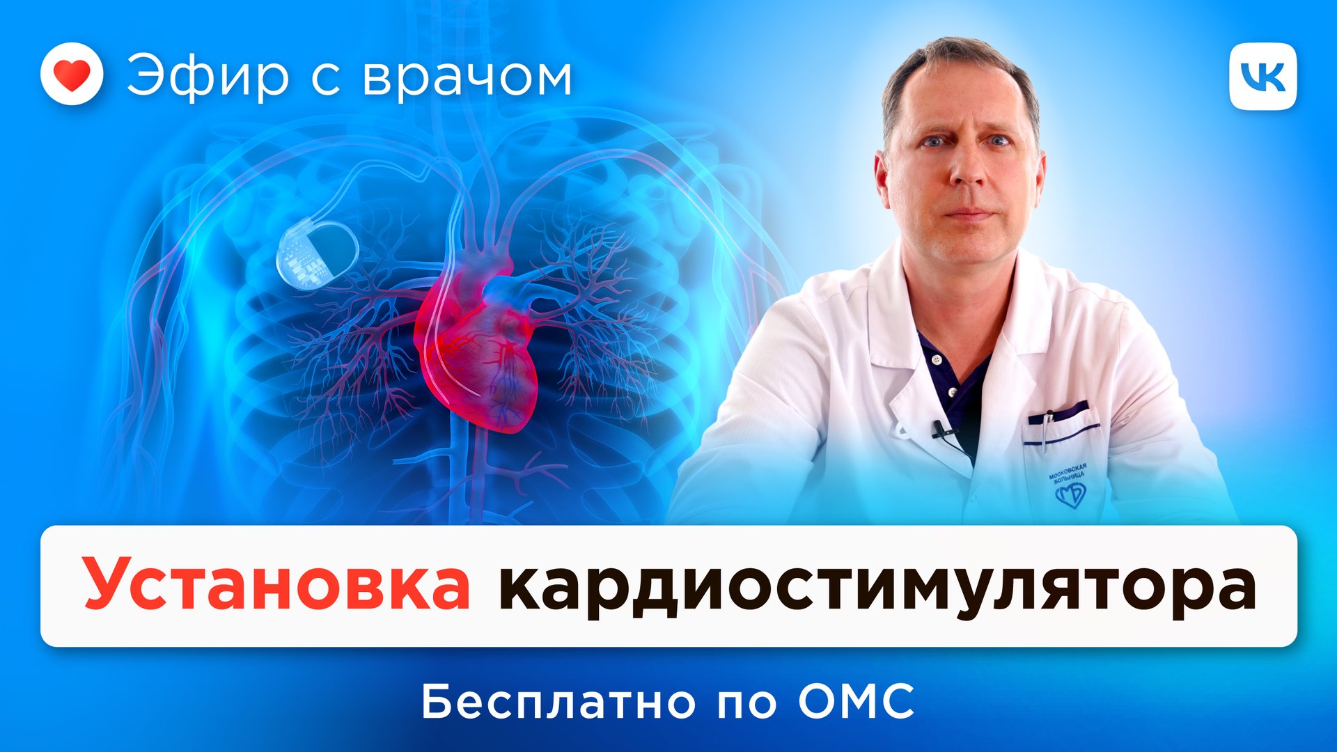 Имплантация электрокардиостимулятора бесплатно по ОМС смотреть онлайн