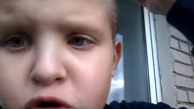 Порезал палец до костей смотреть онлайн